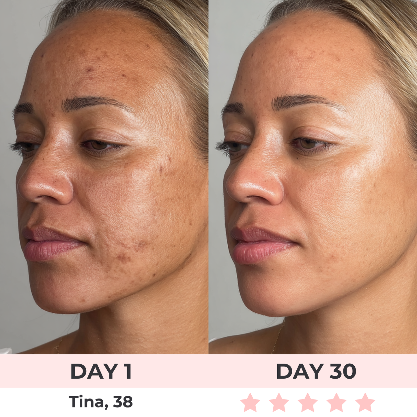 7-en-1 Luxaire Facial Sculptor