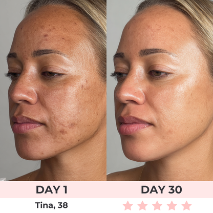 7-en-1 Luxaire Facial Sculptor